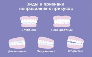 Проктологические заболевания, которые можно лечить лазером